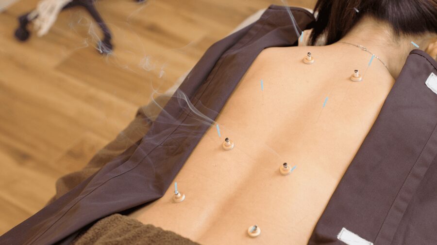 Hiroshima: Acupuncture and Japanese unique massage treatment - Japanese-style chiropractic (“nerve chiropractic”) for gentle movement relief